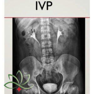 IVP